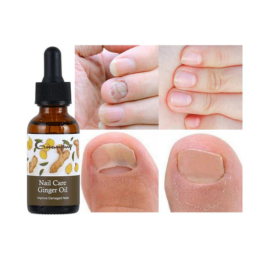 Nail Care Ginger Oil